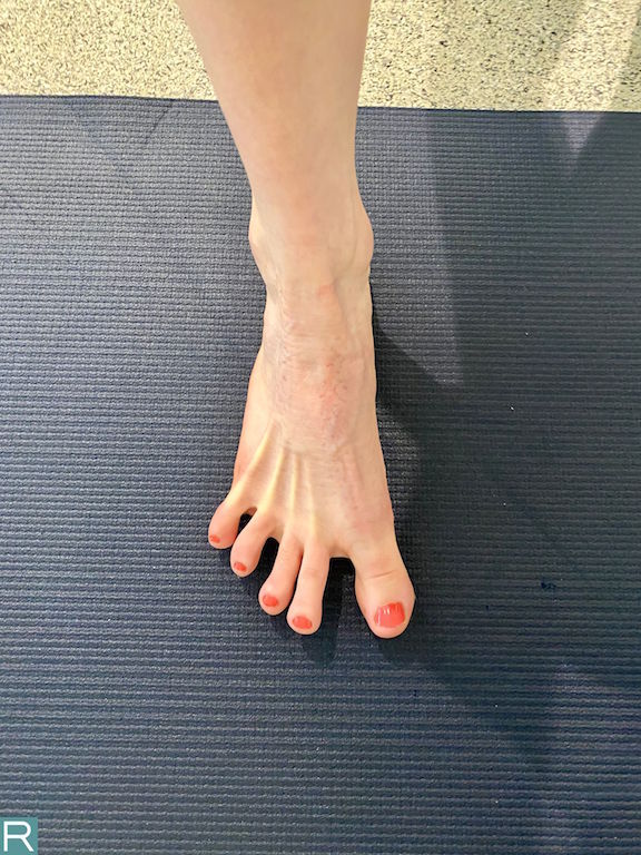 Building A Core For The Foot Release Physical Therapy