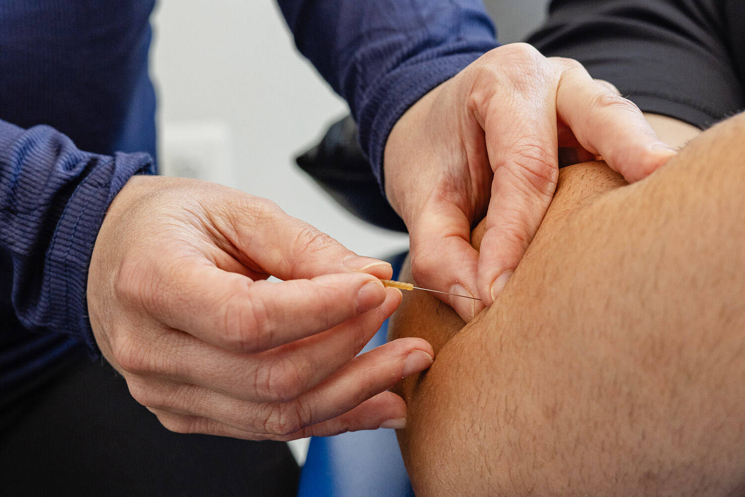 Dry needling Washington DC