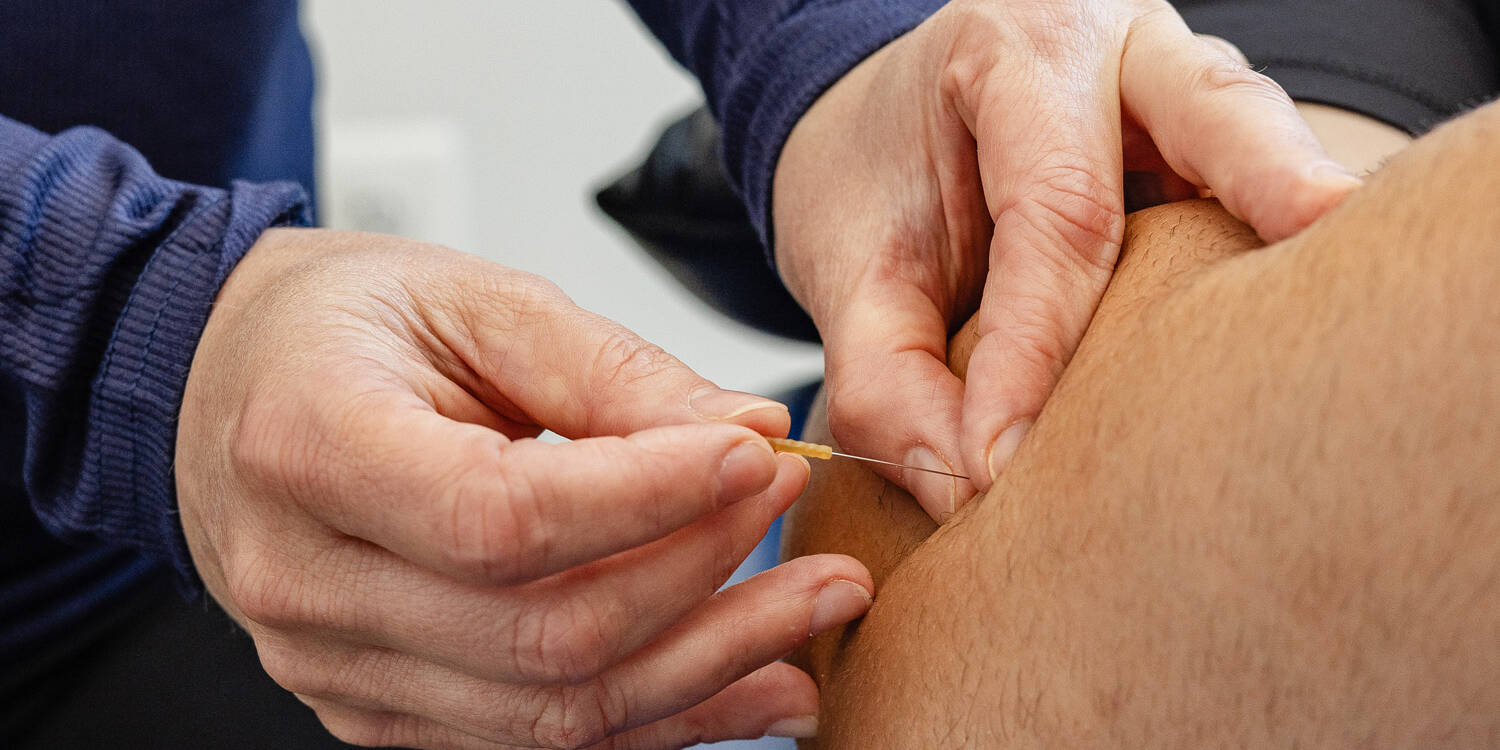 Dry needling Washington DC